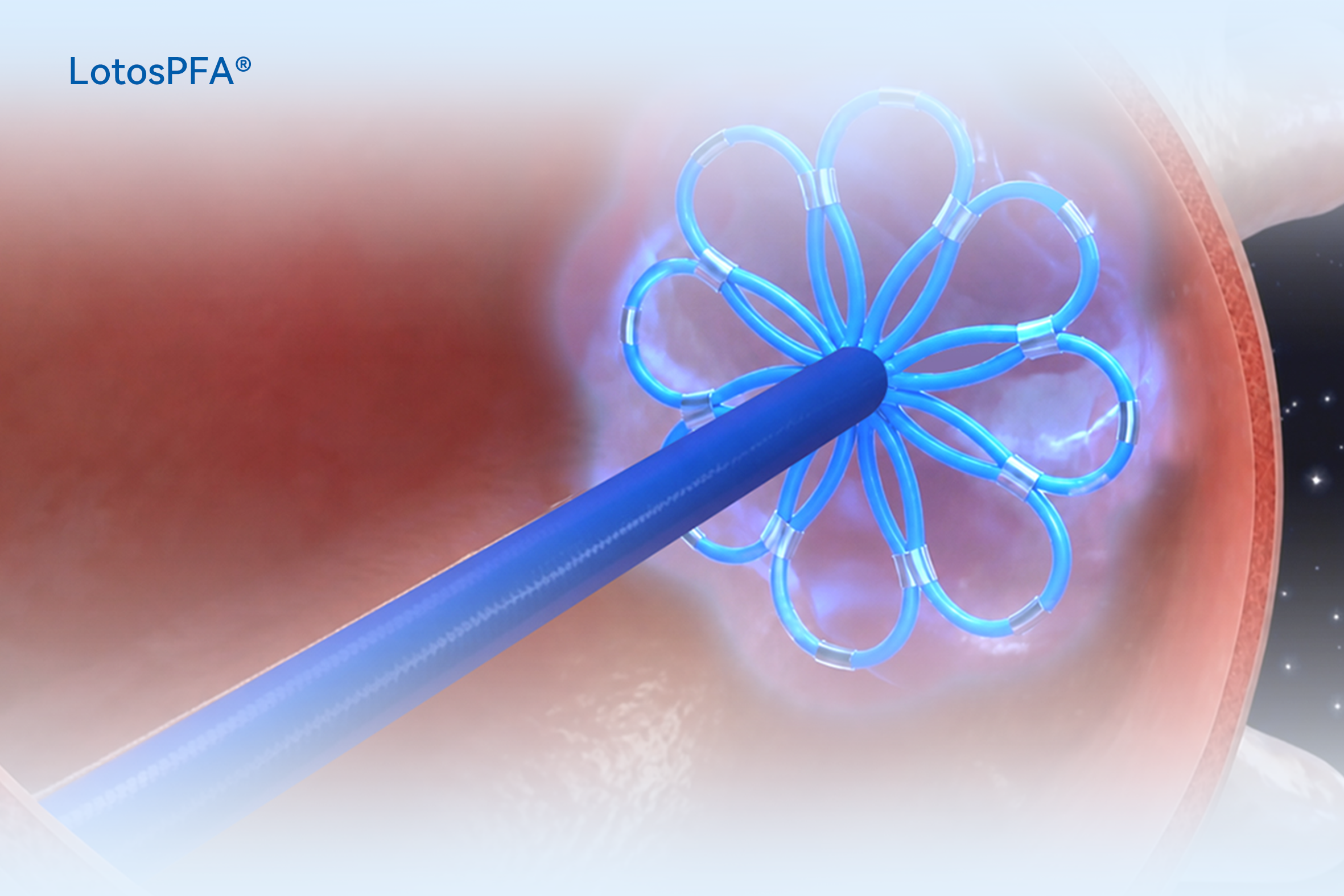 38163614b38806cee529c8b29c3b8adc_origin_20260910102927.png